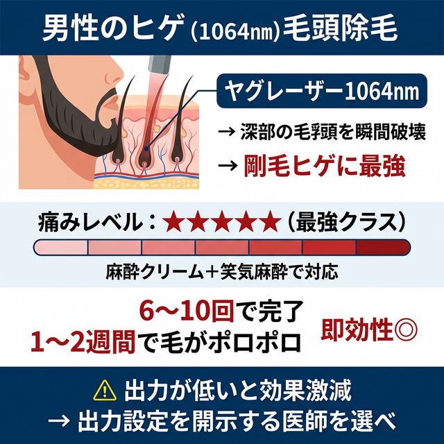 ヤグレーザーの深部到達力と激痛の構造