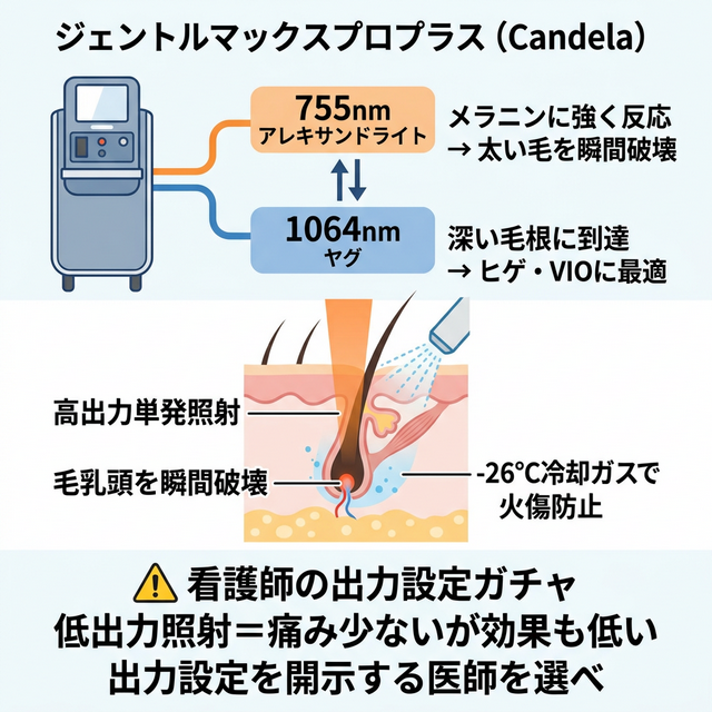 ジェントルマックスプロの2波長切替と看護師出力ガチャの構造