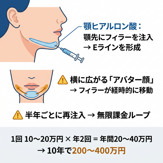 顎ヒアルロン酸のアバター顔リスクと無限課金ループ