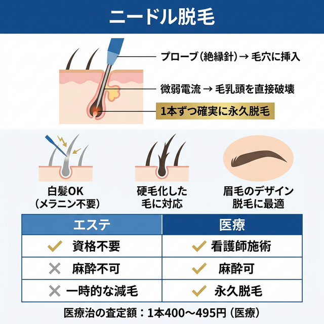 ニードル脱毛のメカニズムとエステvs医療の違い
