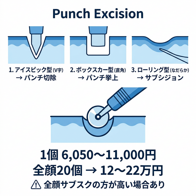 3種のクレーター型とパンチテクニックの対応を示すインフォグラフィック